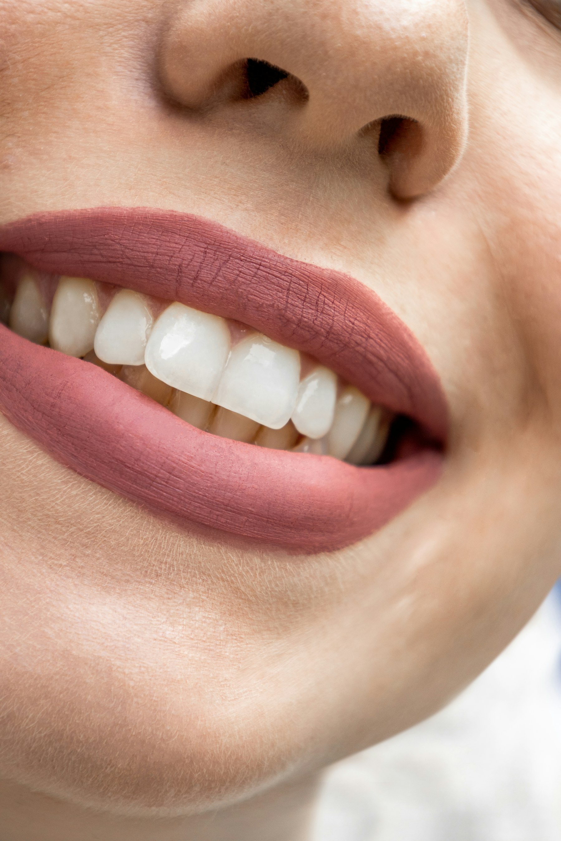 Referencia editorial relacionada con luminosidad de la sonrisa