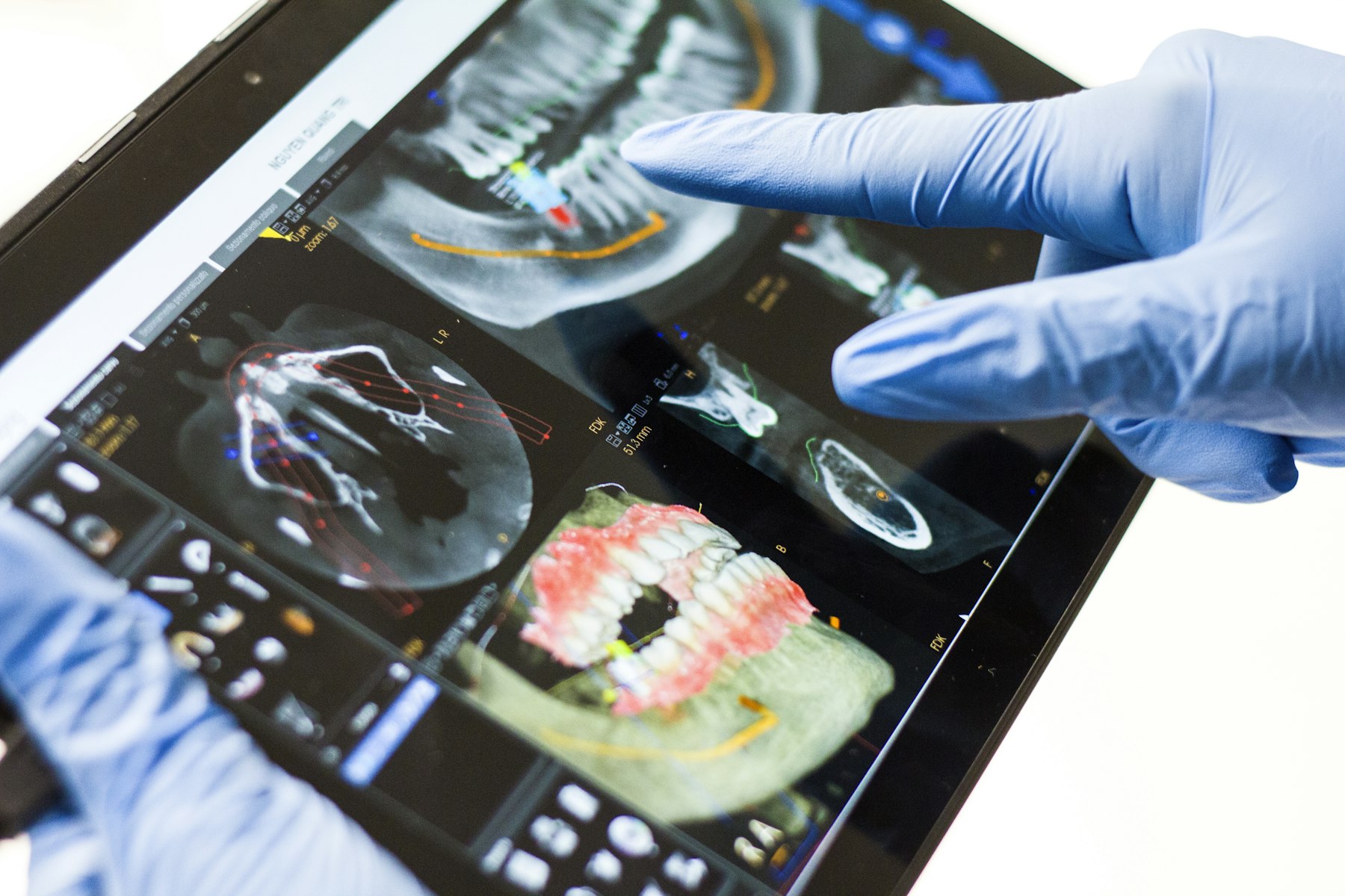 Referencia editorial de planificación dental digital